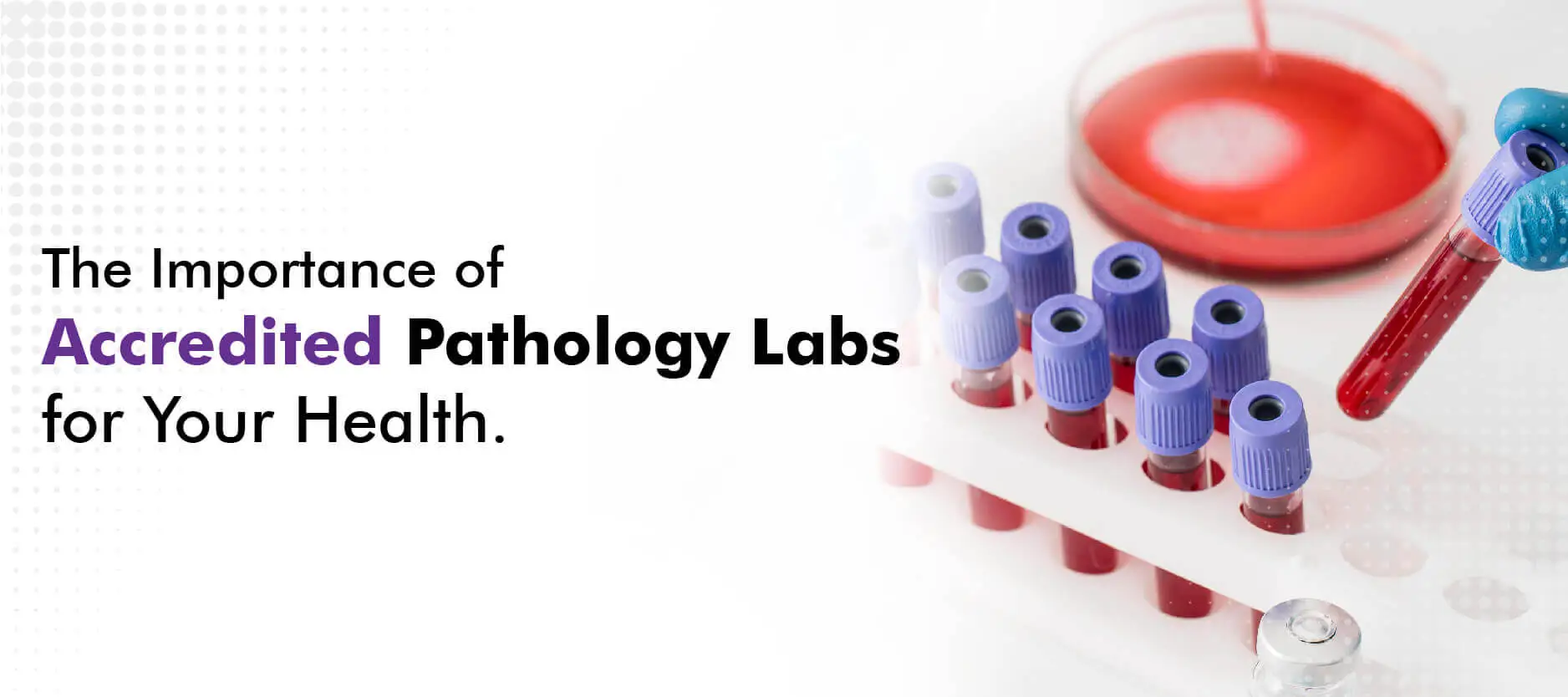 The Importance of Accredited Pathology Labs for Your Health