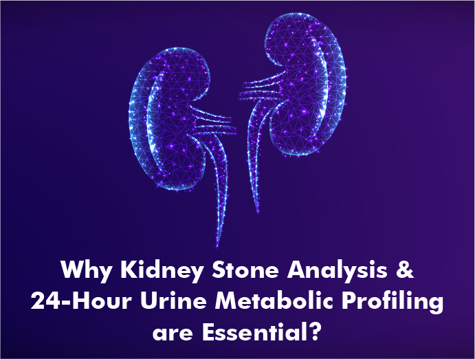 Kidney Stones – Exploring Types, Causes, Tests, and Prevention